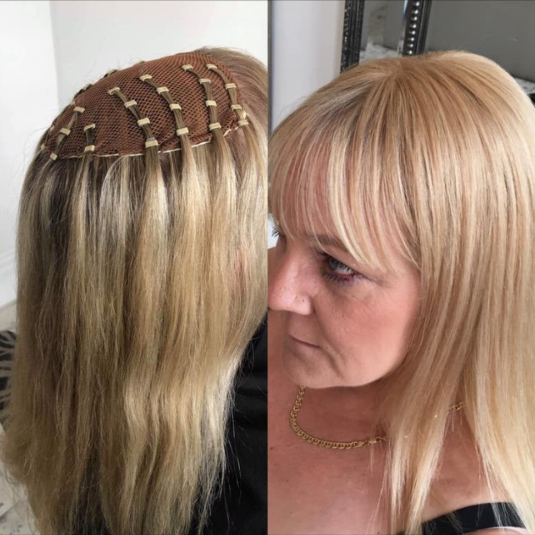 Hair Loss When Gets Real, Mesh Integration before and after