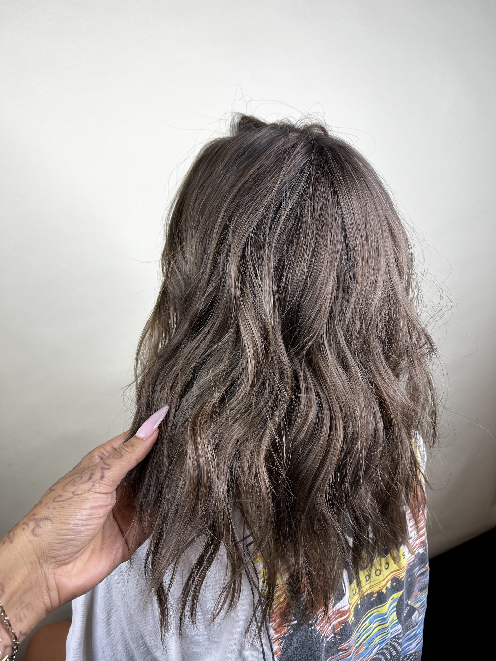 Hair Loss Solutions for hair loss on the crown
