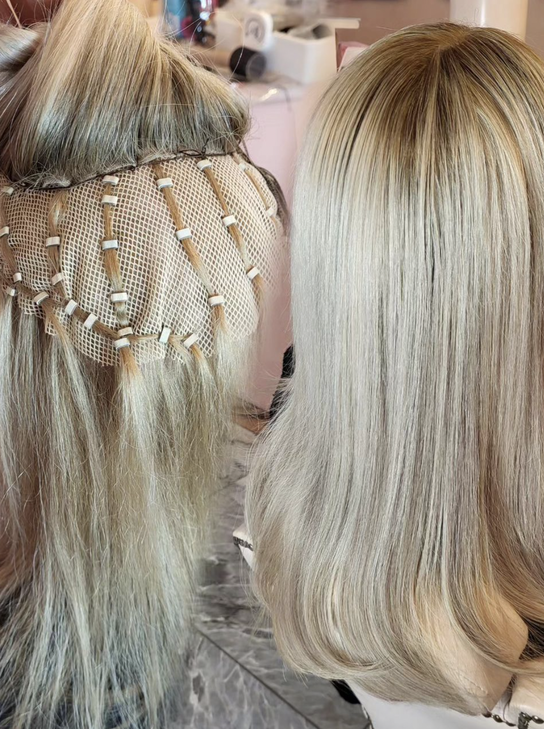 Seeking Mesh Integration Models: Advanced Solutions for Hair Loss hair loss solutions