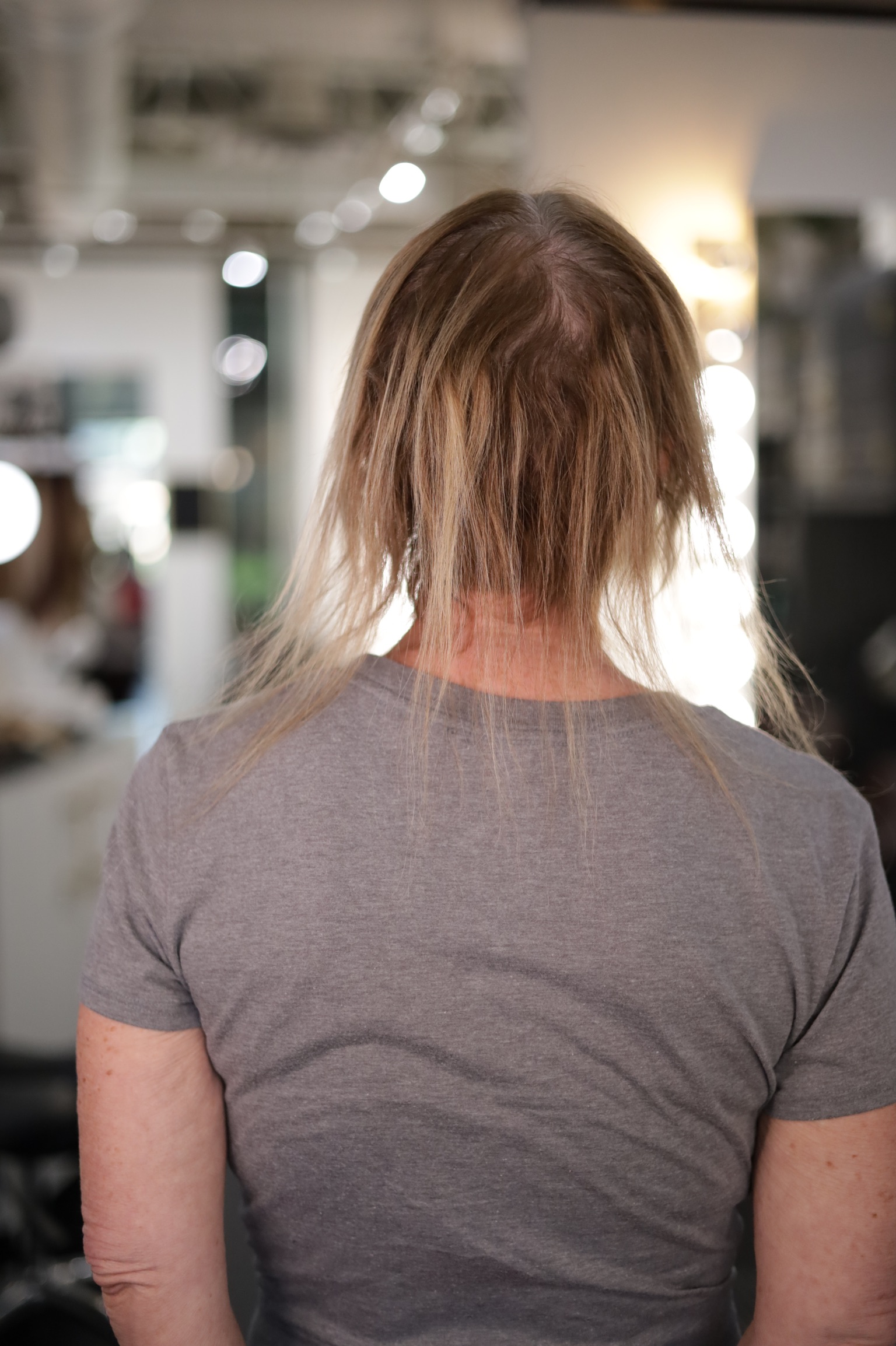 A Garnish guest with thinning hair