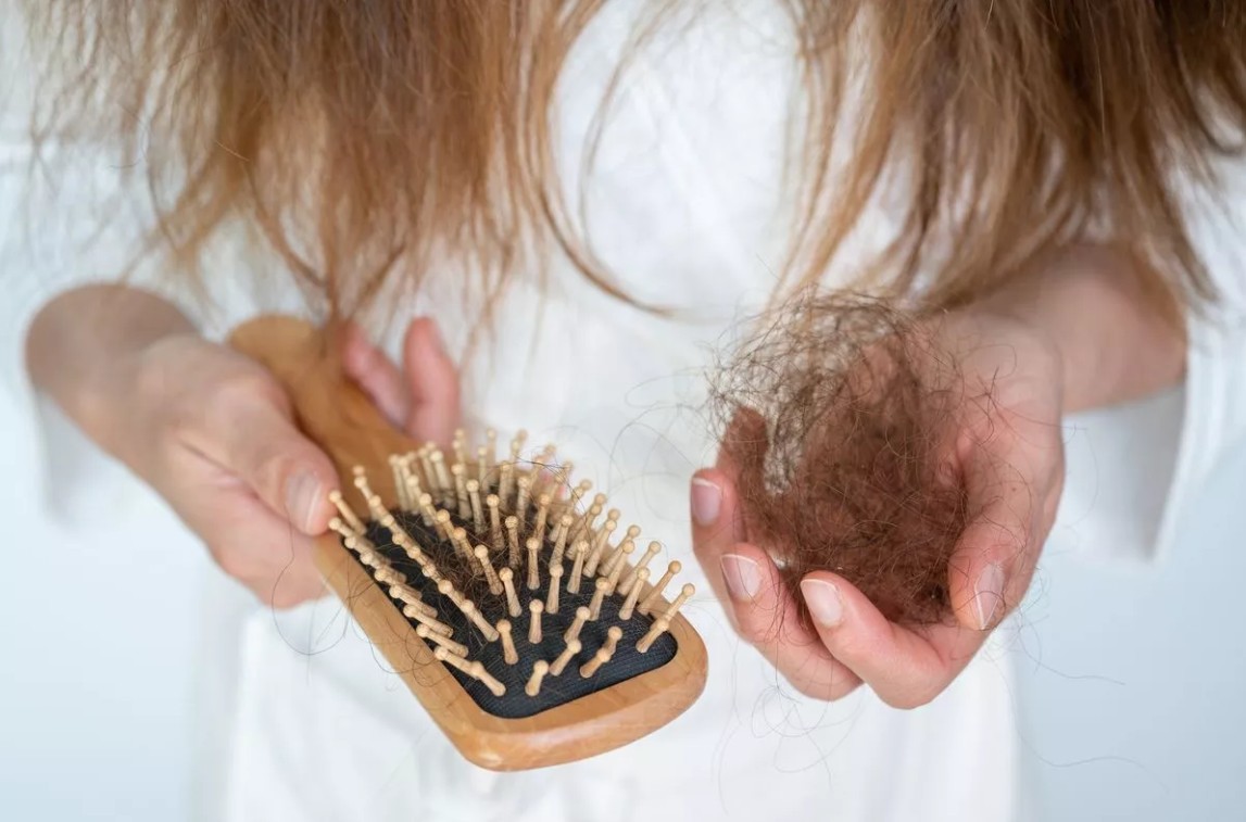 a woman experiencing hair loss and weight loss pulls shed hair out of a brush