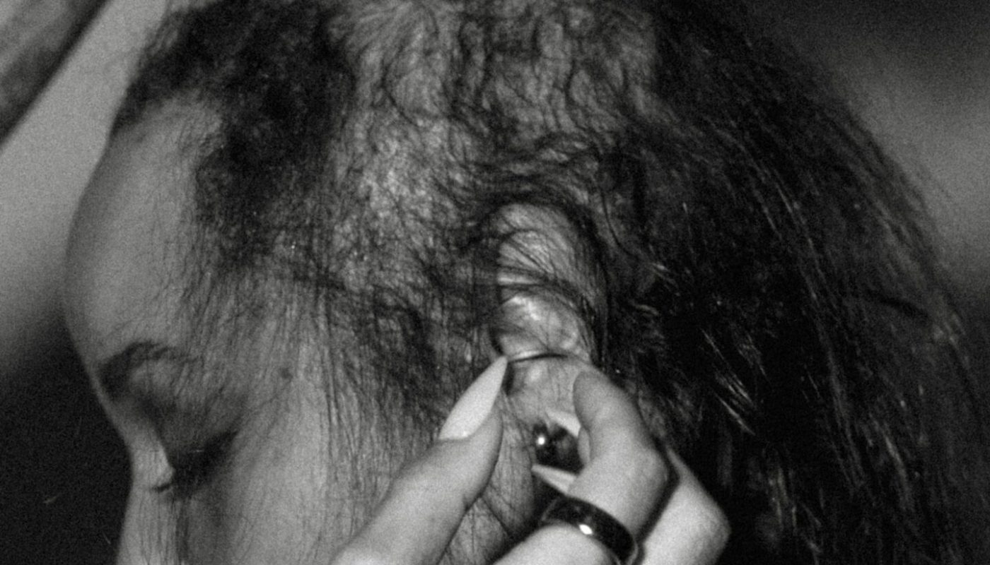 a stylist gently lifts thinning strands of hair, showing hair loss in women