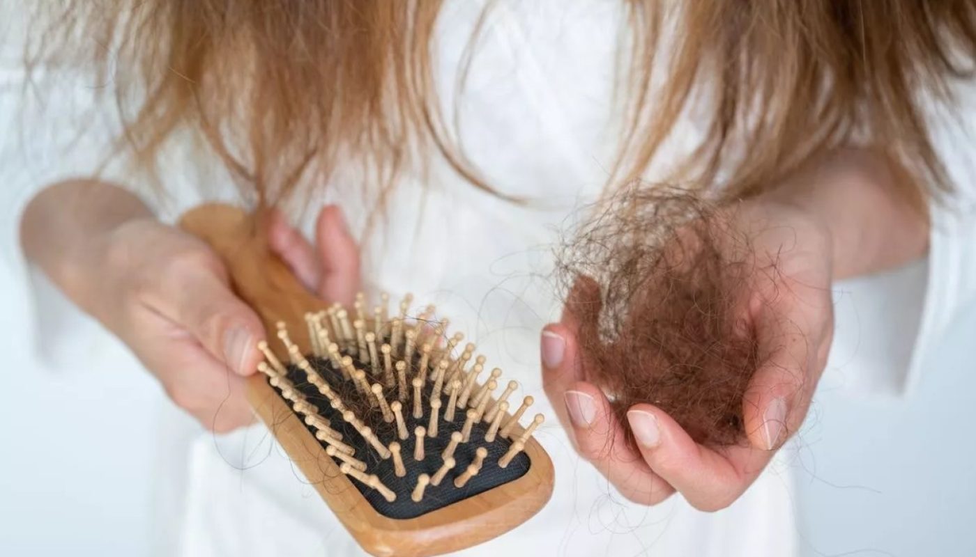 a woman experiencing hair loss and weight loss pulls shed hair out of a brush
